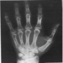icon Radiologia ręczna
